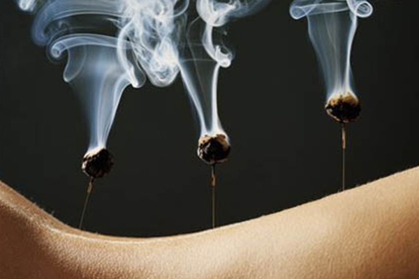 image of moxibustion, a traditional Chinese medicine therapy which consists of burning dried mugwort on particular points on the body.